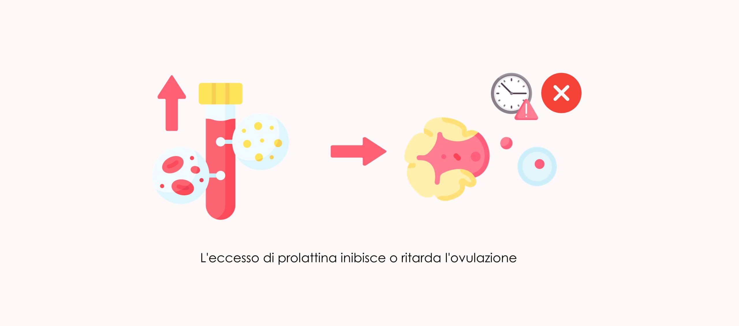 Le 5 principali malattie che causano infertilità nelle donne